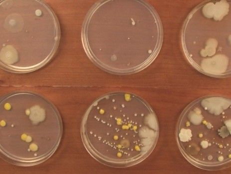 Microbiology Update: Availability of Antimicrobial Susceptibility Testing for New Antimicrobial Agents