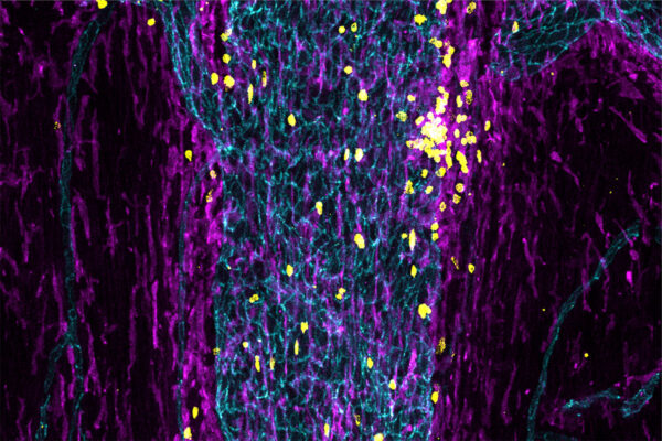 Morey A.  Blinder, MD