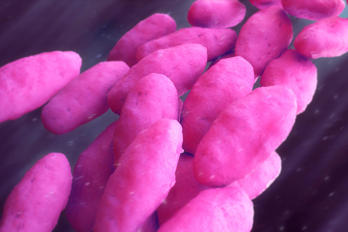 Jennifer Alexander-Brett, MD, PhD