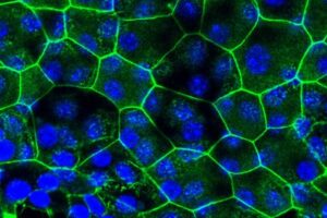 Why do some people get UTIs over and over? A new report holds clues