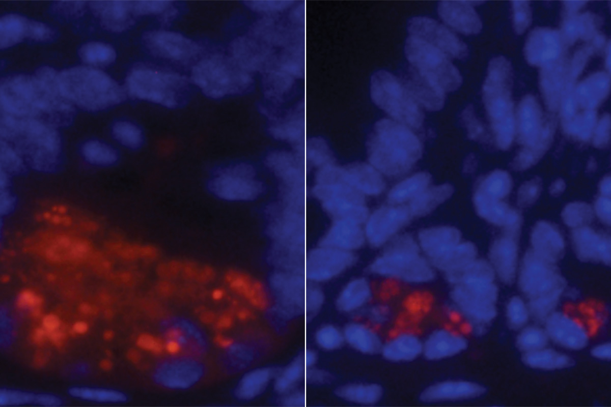 Michael A. Paley, MD, PhD