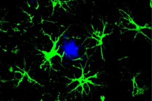 Enhanced brain cells clear away dementia-related proteins