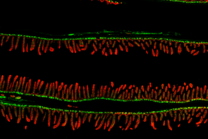 Gut bacteria linked to malnutrition may pass to younger generations